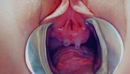 Pisshole Games of Sklavins