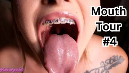 Braces Mouth Tour 4