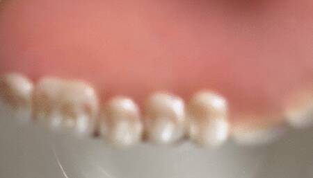 Cleaning my Denture