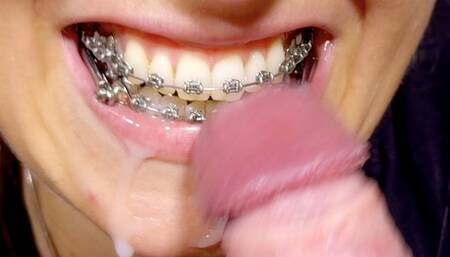 Braces HERBST German dirty-talk, HUGE cumshot