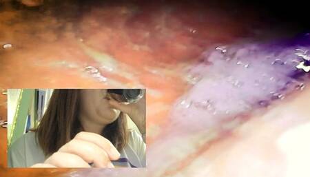 Eating a margherita pizza swallowing pillcam in public restaurant 720HD