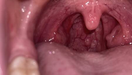 MOUTH TOUR FLASH ON DEEP INSIDE MY MOUTH