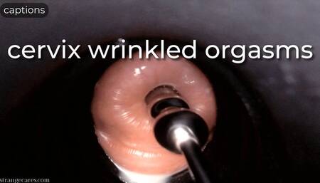 cervix wrinkled orgasms