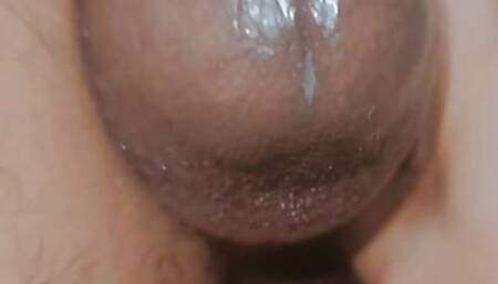 Sensitive huge black gland ????