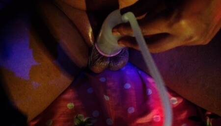 dick enlargement challenge  ... day 1