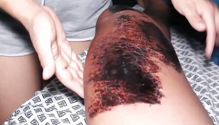 My cock gets hard during my rehab therapy and my stepmom helps me lower my erection!