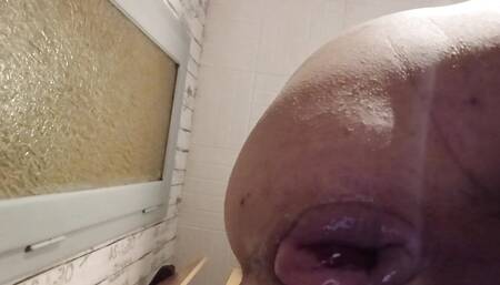 Anal destruction