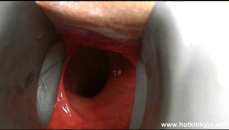 Sexy Blonde Nurse with Huge Speculum in Her Ass by Hotkinkyjo