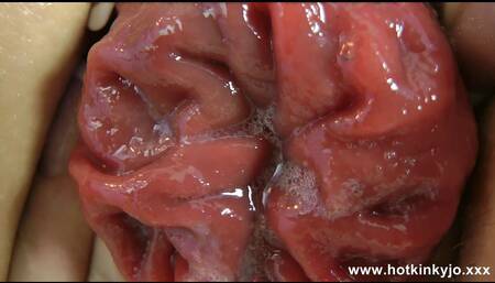 Sexy Hippie Hotkinkyjo with Huge Plug in Ass & Prolapse Fun