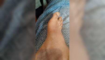 Feet that smell like cheese