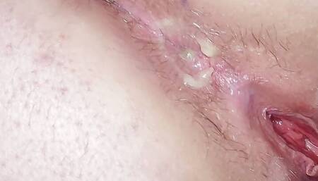 Anal beads deep in my ass