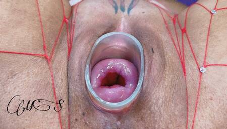 Inserting 7 spoons and 7 dessert forks into my cervix