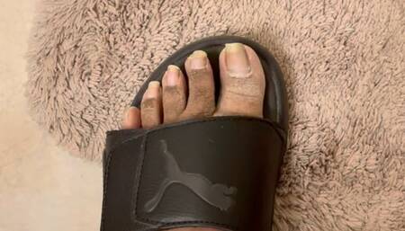 Ashy Feet, Crusty Heels and Long Toenails