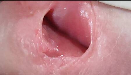 Young man prepares his dick for transplant surgery.