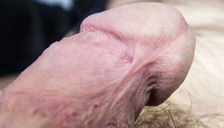 Tough Circumcision Reality