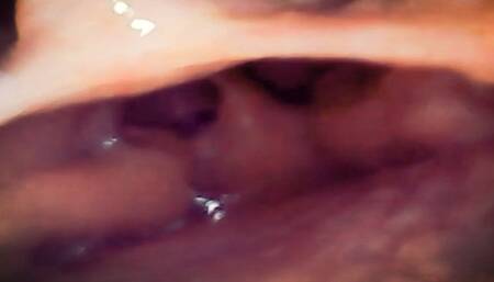 A Journey into the Depths: Exploring My Gut with PillCam, Through Sounds and Images of a Hidden World 720HD