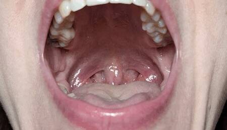 Mouth, tongue and uvula movements closeup 2