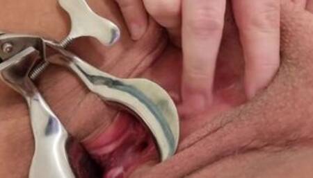 BBW shaved pussy stretched by speculum and cervix play