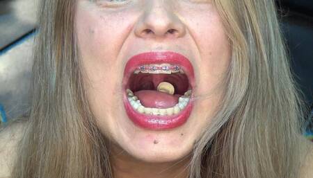 I Swallowed 32 Chess Pieces!!