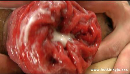 Fist Punch Fun Play & Anal Prolapse Hotkinkyjo
