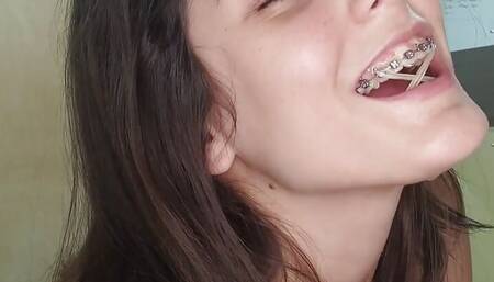 Cum on butterfly braces