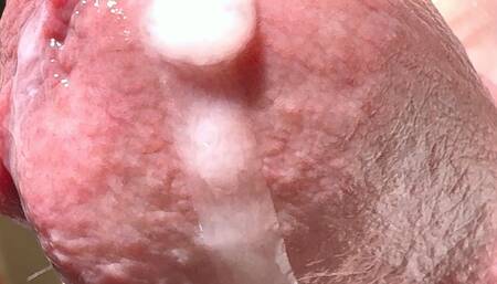 Penis close-up with