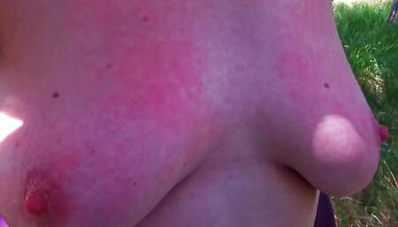 Hard and well slapped fat tits