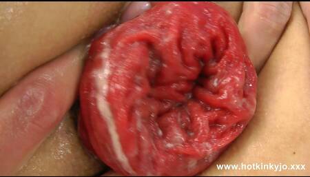 Dig with Fist in the Ass & Anal Prolapse by Hotkinkyjo