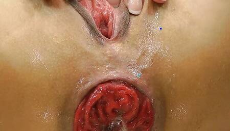 Hotkinkyjo Have Anal Fun with Big Blue Bottle & Prolapse