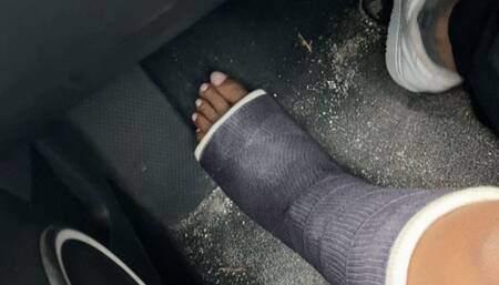 Lady phoenix drives in her foot cast