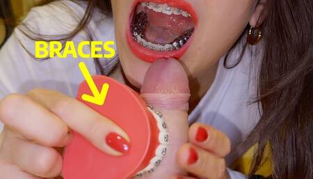 Braces HERBST cock-biting with braces-model, CUM on teeth