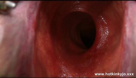 Hotkinkyjo Xo Speculum Deep Dildo and Belly Bulge Fun