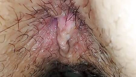 Anal
