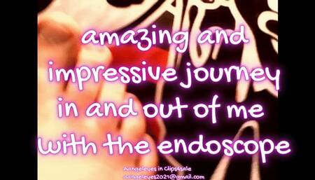 AMAZING AND IMPRESSIVE JOURNEY!! in and out of me with the endoscope
