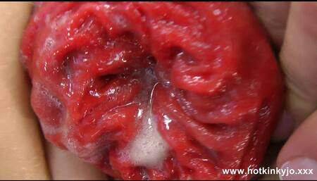 Hotkinkyjo Bottle Anal Insertion and Prolapse Push Out