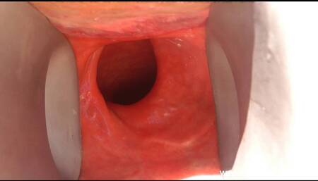 Hotkinkyjo Open Her Ass with Xxl Speculum and Fuck It 40cm Deep with Dildo