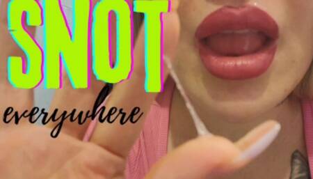 Snot Everywhere!