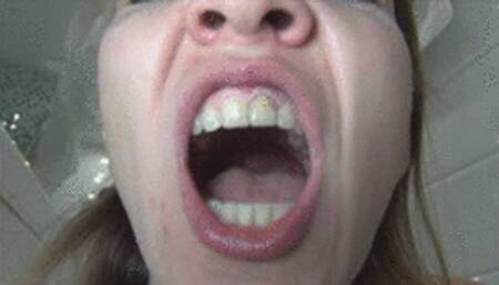 Dirty teeth and bad breath