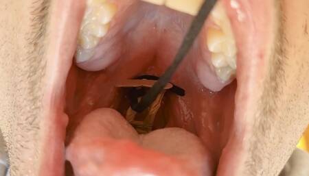 William's little vore explorer