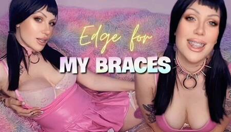 Edge for My Braces