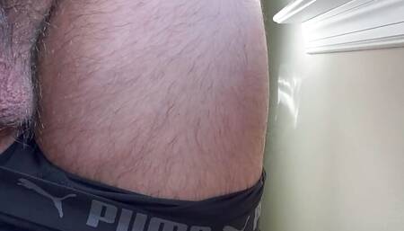 Patient with reoccurring moderate erections issues