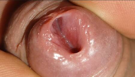 Excitado28