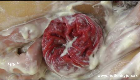 Fist Fuck Banana Split & Prolapse by Hotkinkyjo