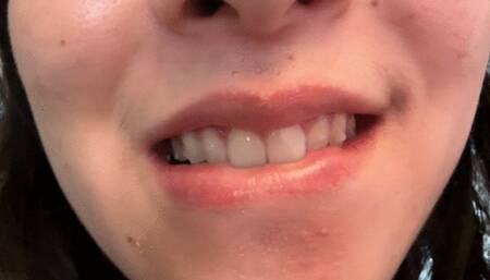 Aurora’s Sexy Teeth Strike Again