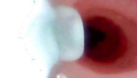 A detailed examination of Lopuza93 oral cavity and anal area using an endoscope camera.