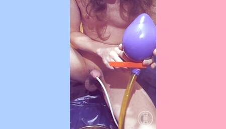 Bladder inflation 700 ml Balloon