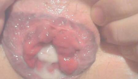 Femboy Butt Stretched to the Limit and Prolapse