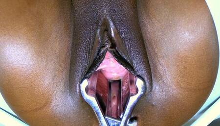 Babe Pussy GYNO - Mathieu Speculum Close-Ups