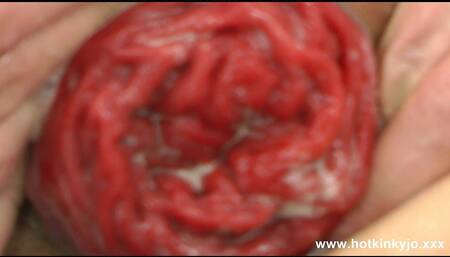 Zebra Sexy Self Anal Fisting & Prolapse