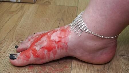 Fire of Hurt: Worship Through Wax